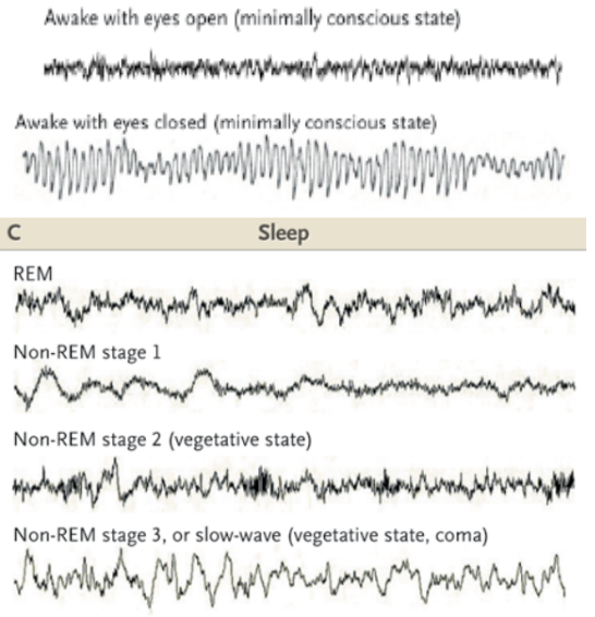 [@brown_general_2010] Fig 1A and C